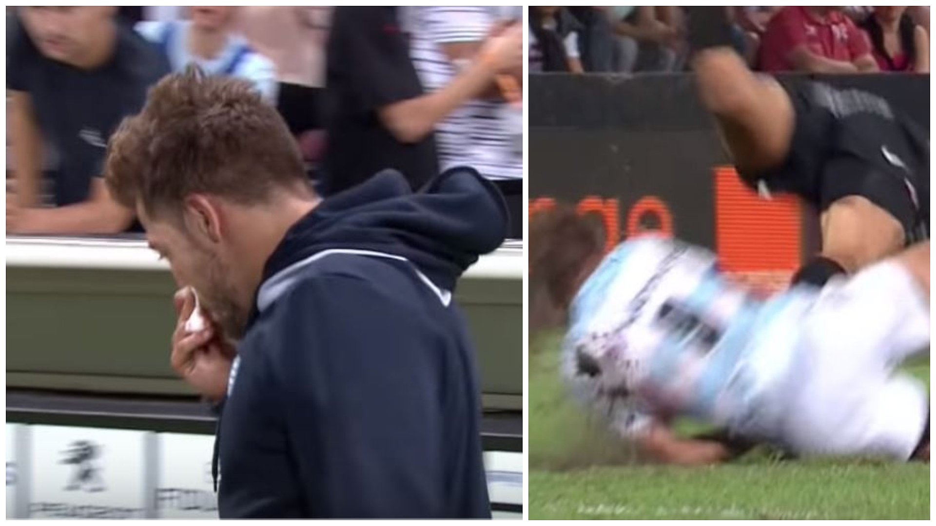 LOOK: Racing scrumhalf left with brutal facial injury after receiving boot to face