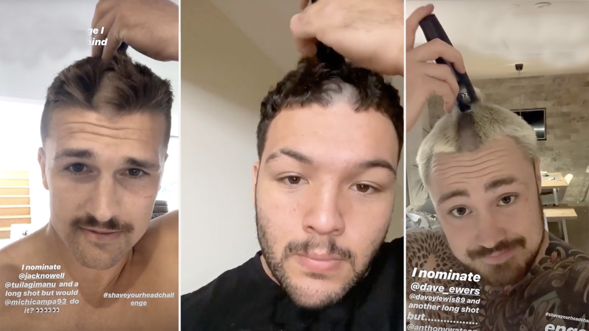 Rugby players all started suddenly shaving their hair off last night and people are confused