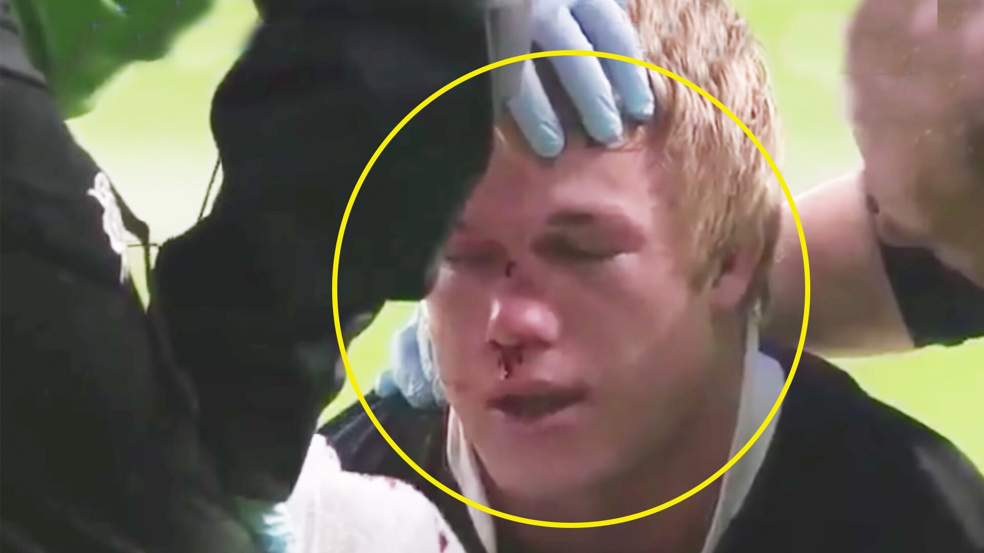 The time Pablo Matera broke Bok hero Pieter-Steph du Toit's face off