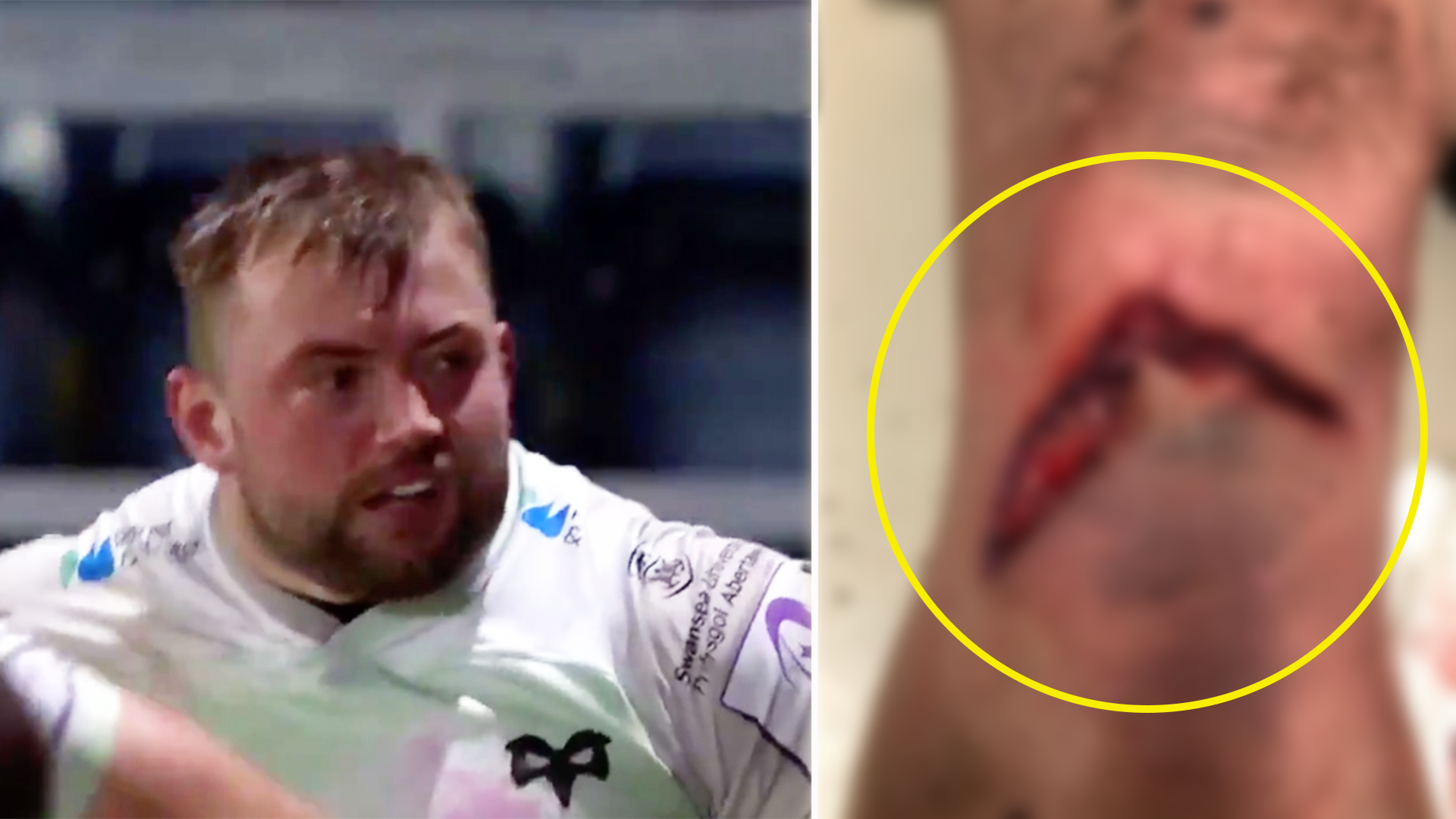 Ospreys hooker shocks fans revealing horrific injuries sustained in last night's Challenge Cup clash
