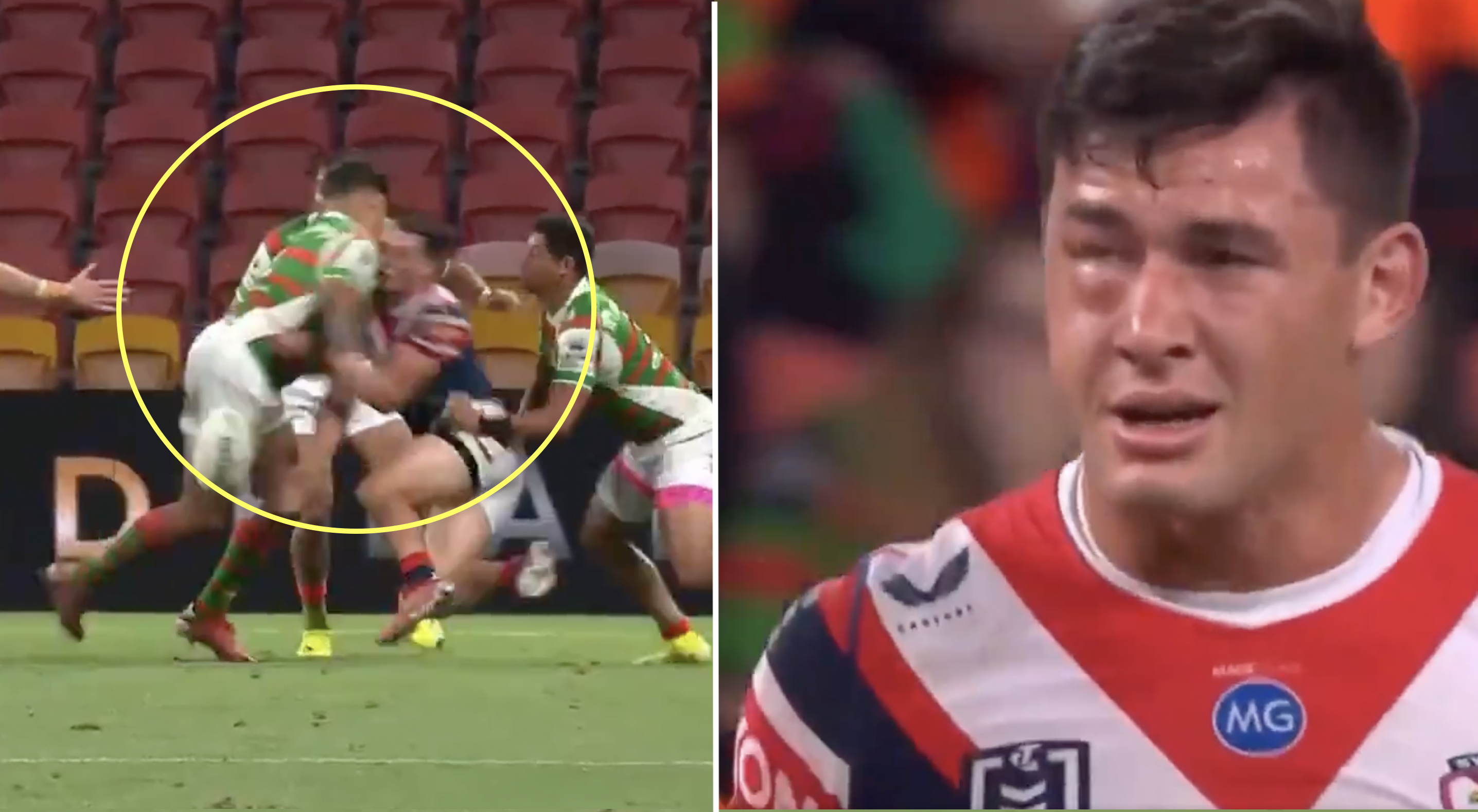 Horror NRL tackle shows league is still lightyears behind union