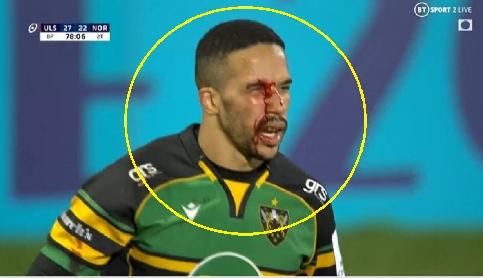 Bok Courtnall Skosan left bloodied after incident in Ravenhill