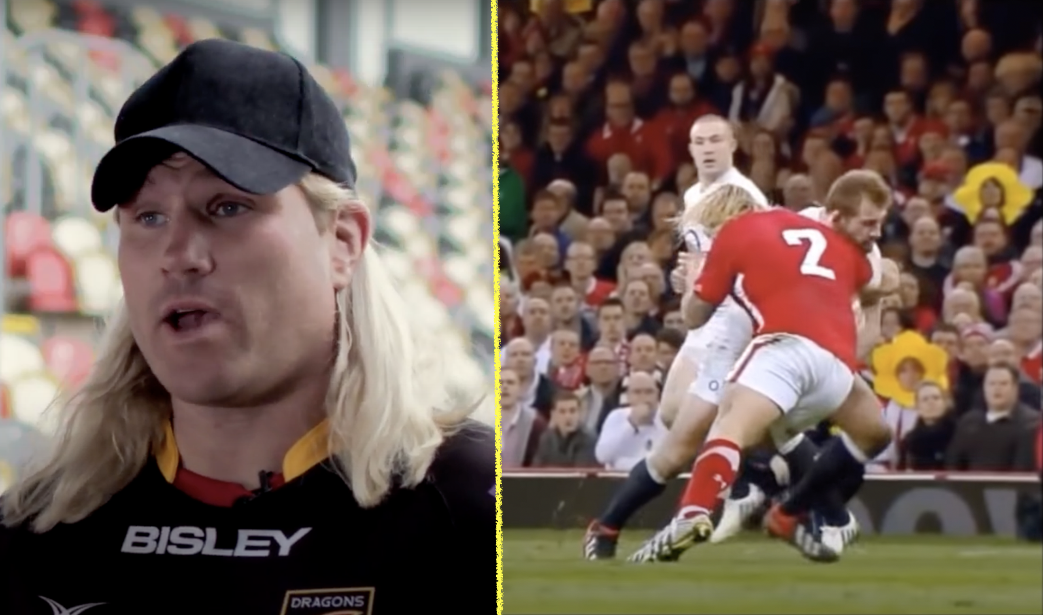 Richard Hibbard shares post retirement x-ray which shows brutal life of pros