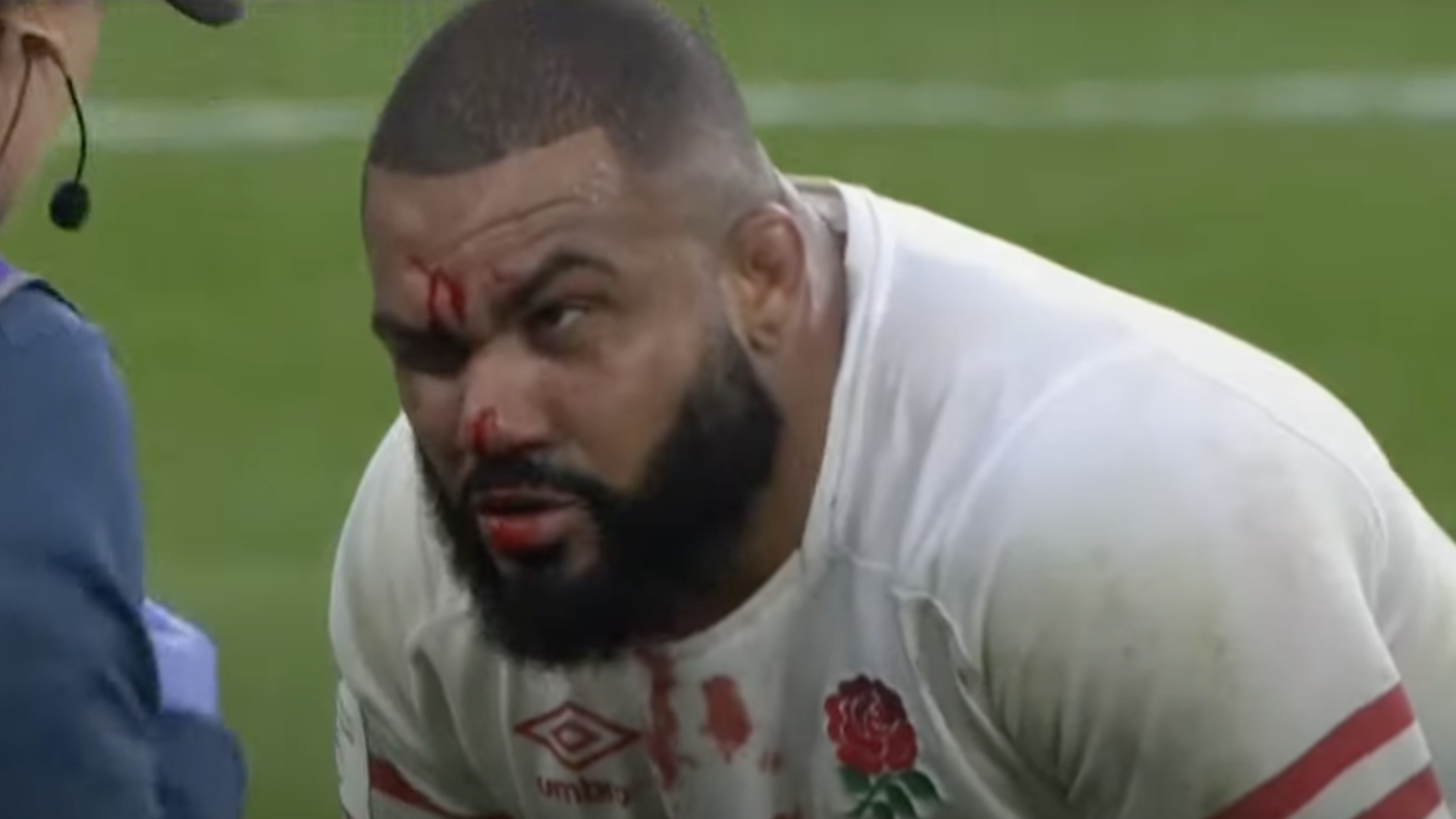 England's Kyle Sinckler reveals new look for Wales match after gory injury