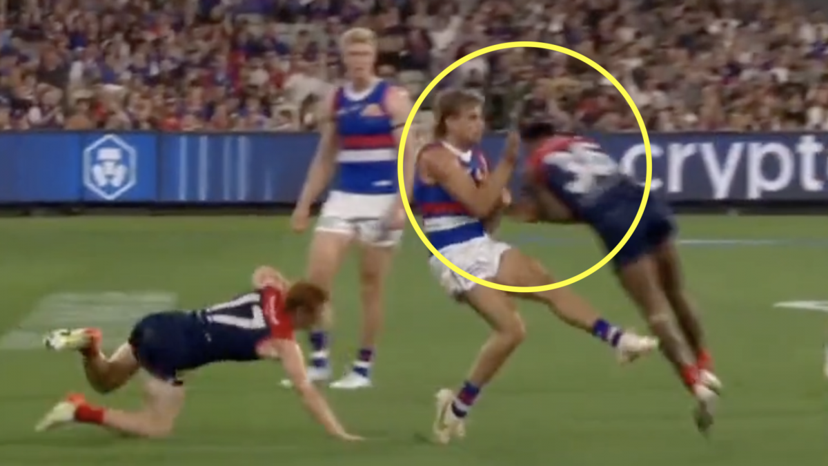 Horror tackle shows rugby union is lightyears ahead of other sports ...